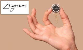 Neuralink By Elon Musk Approved For Brain Chip Trials